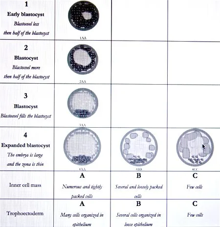 The different grading of a blastocyst